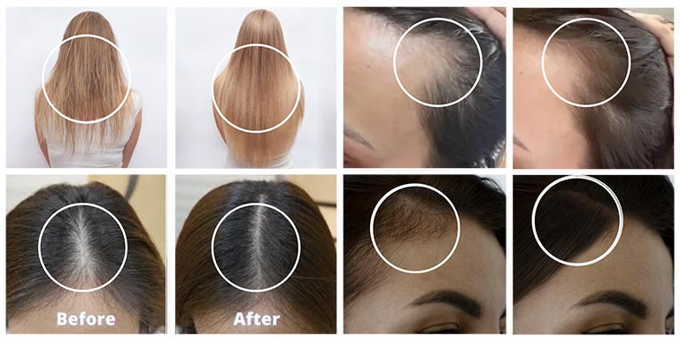 Before and Afters - Complete Biotin Plus