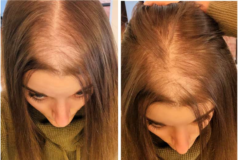 Before using Biotin