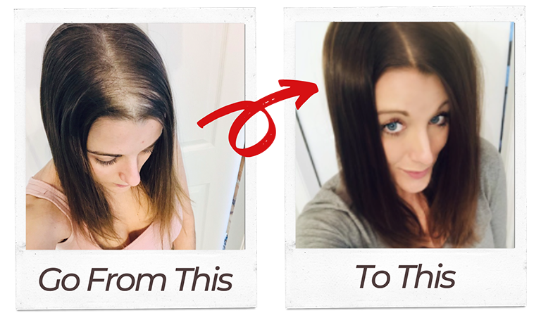Biotin Before and After